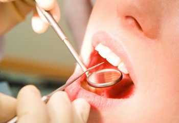 dentysta, zdrowe zęby